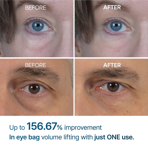 Dr. Melaxin Eyephalt Eye Cream for Eye Bags