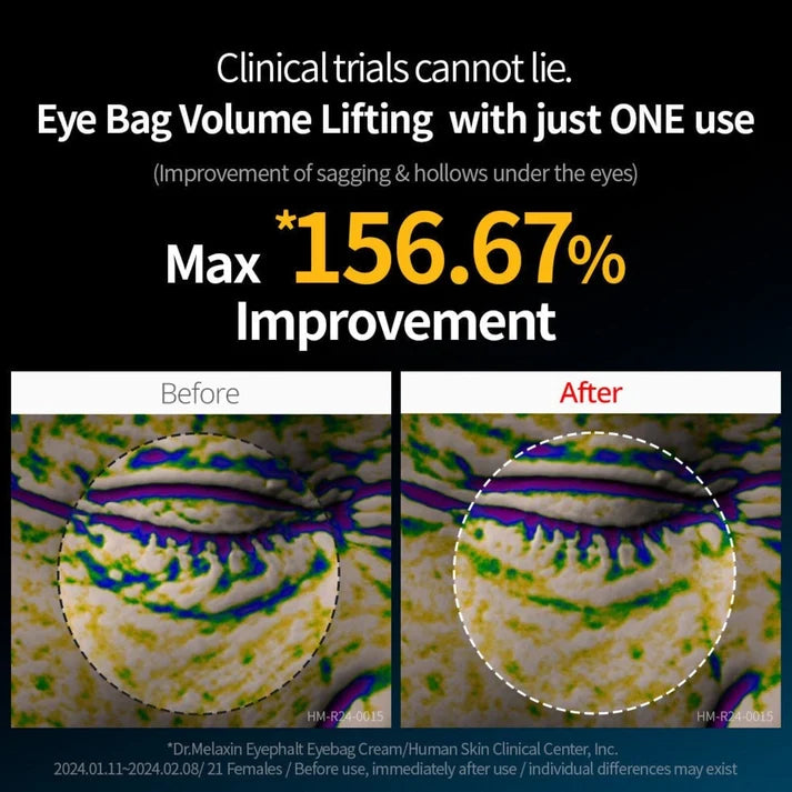 Dr. Melaxin Eyephalt Eye Cream for Eye Bags